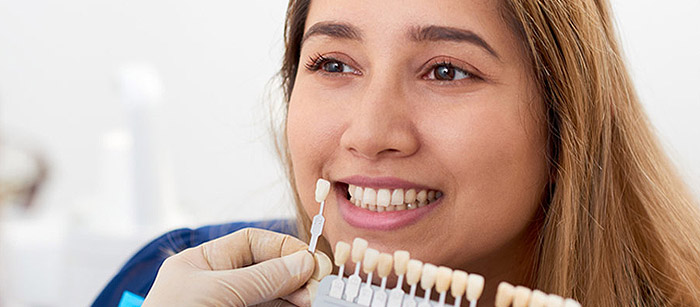 Porcelain Dental Veneers